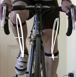 Knee tracking